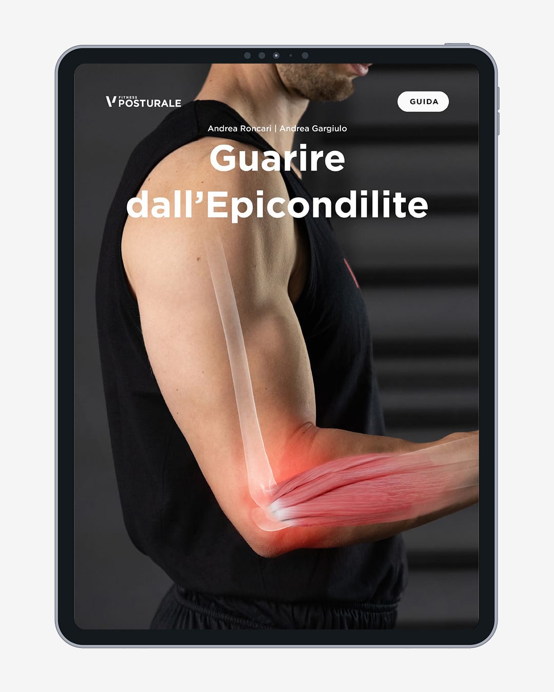 epicondilite pagine 1