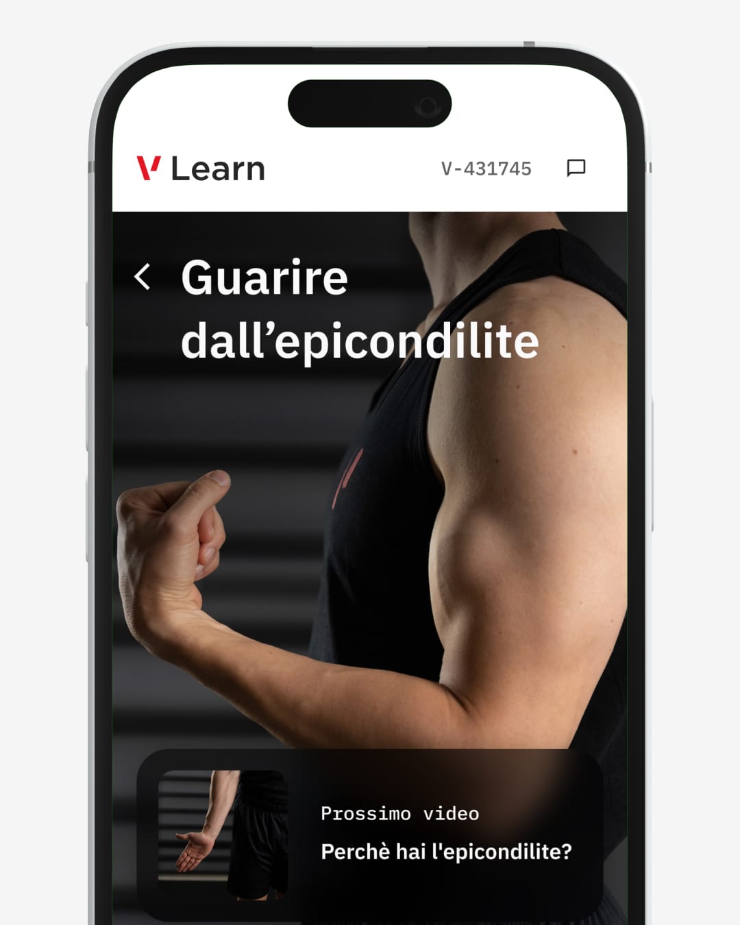 epicondilite pagine 1