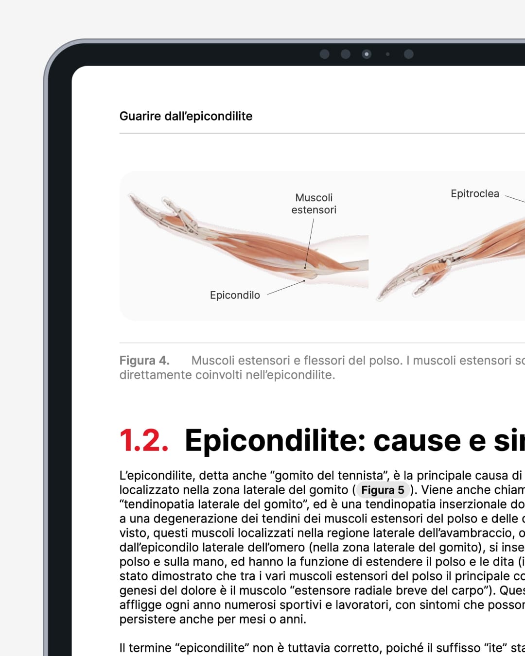 epicondilite pagine 1