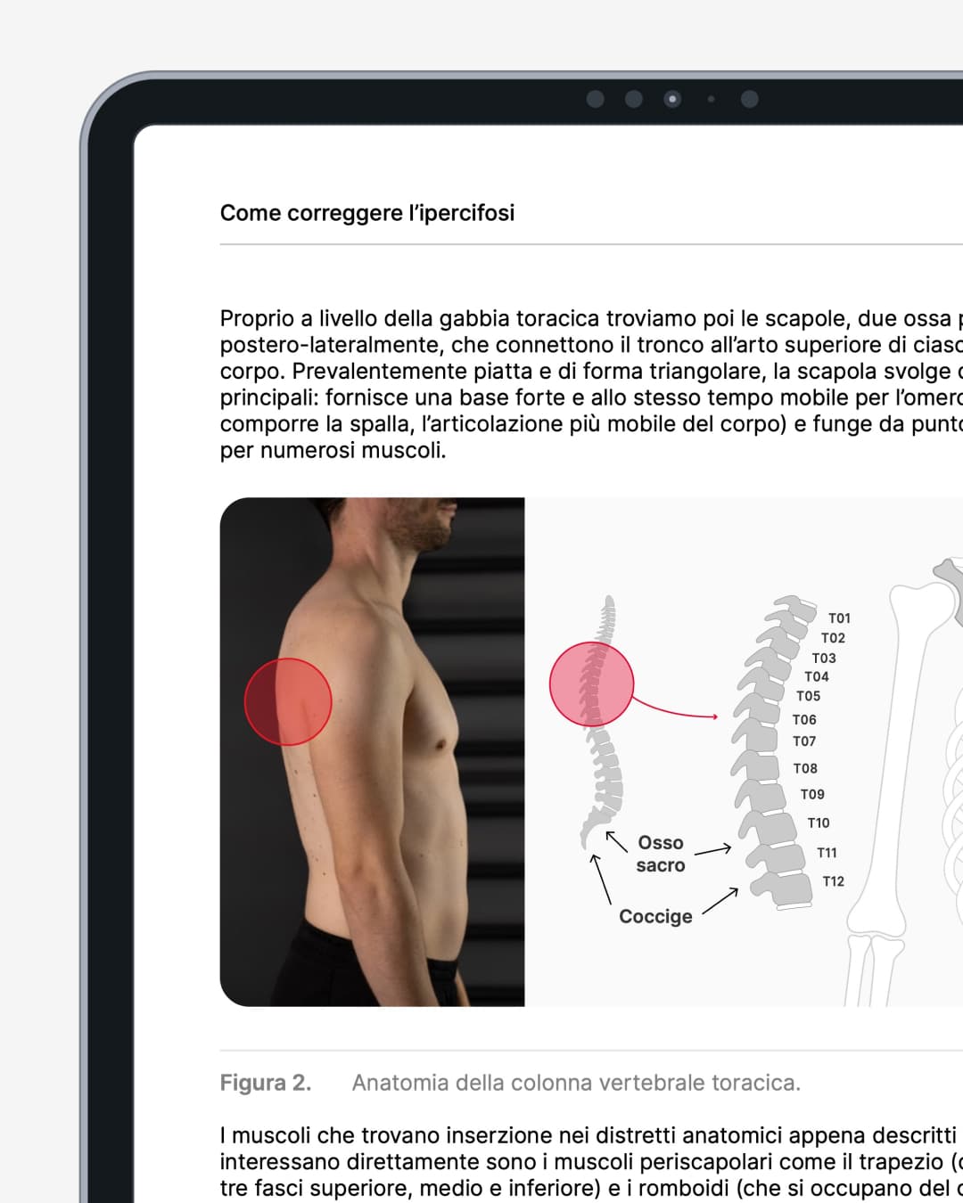 Ipercifosi pagine interne 2