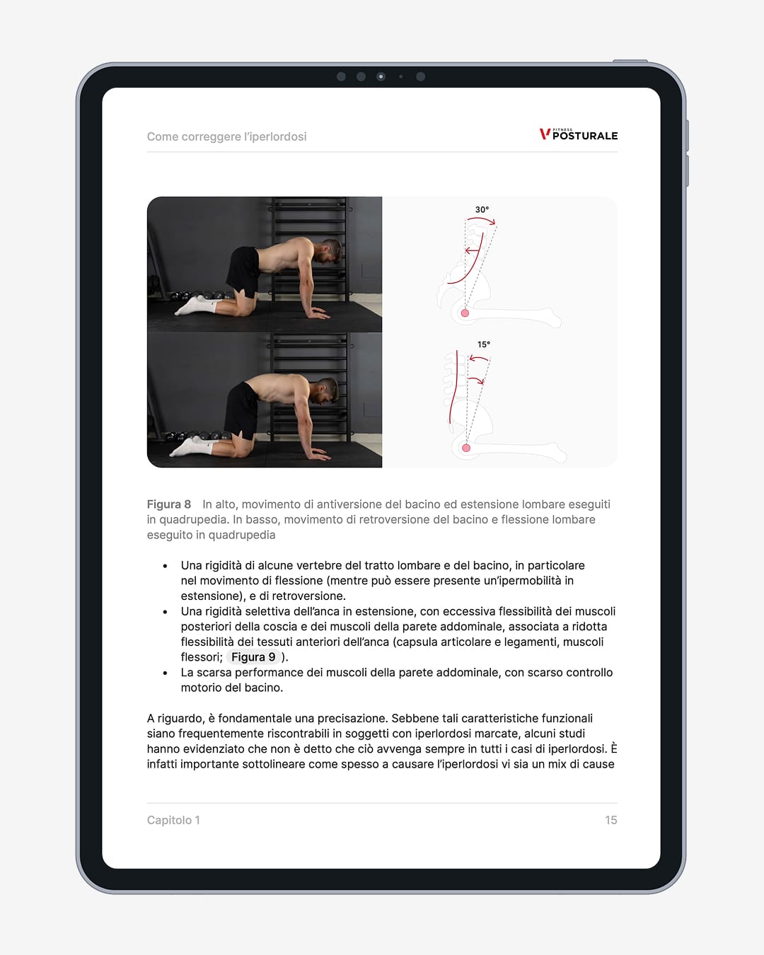 iperlordosi pagine 2