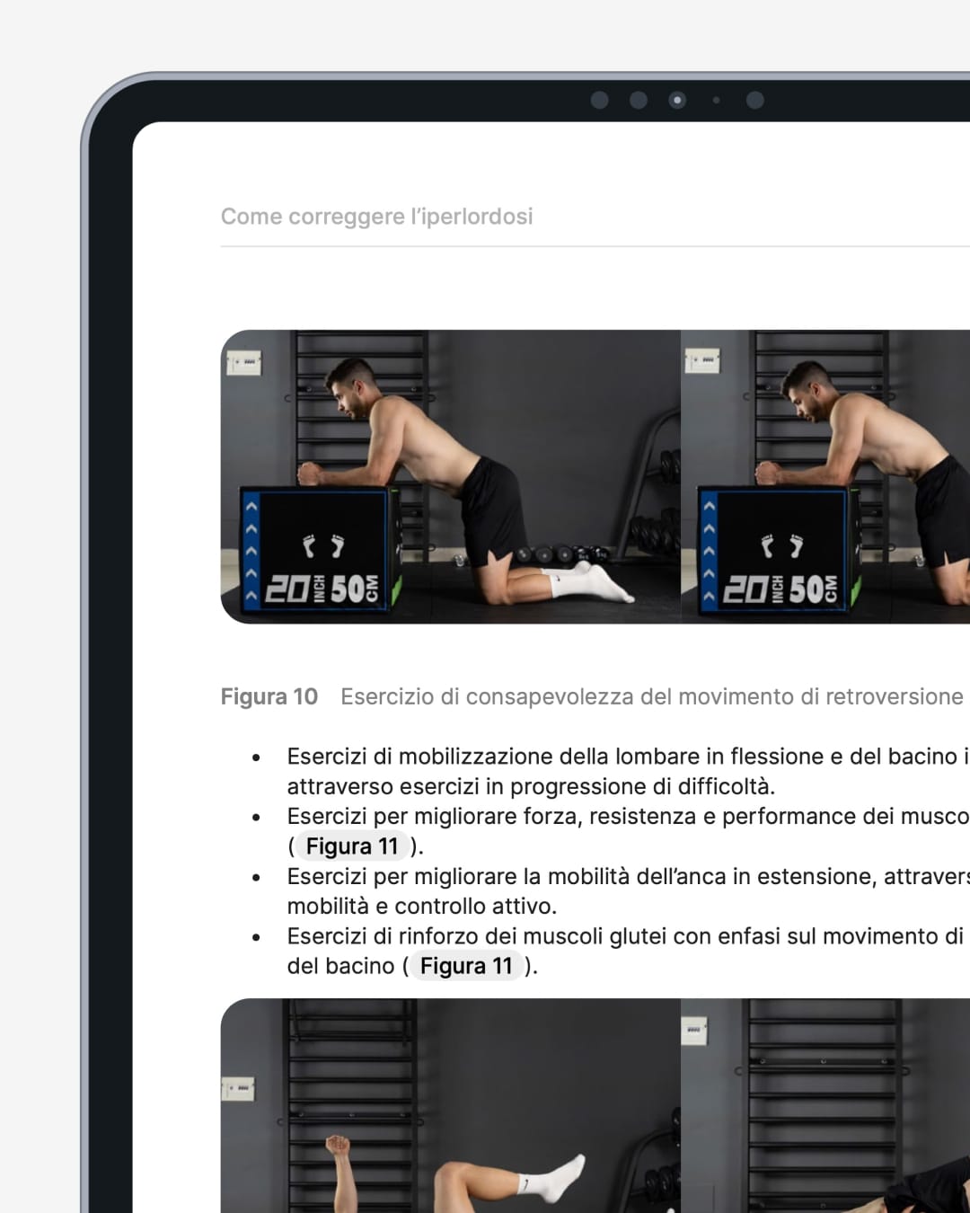 iperlordosi pagine 4