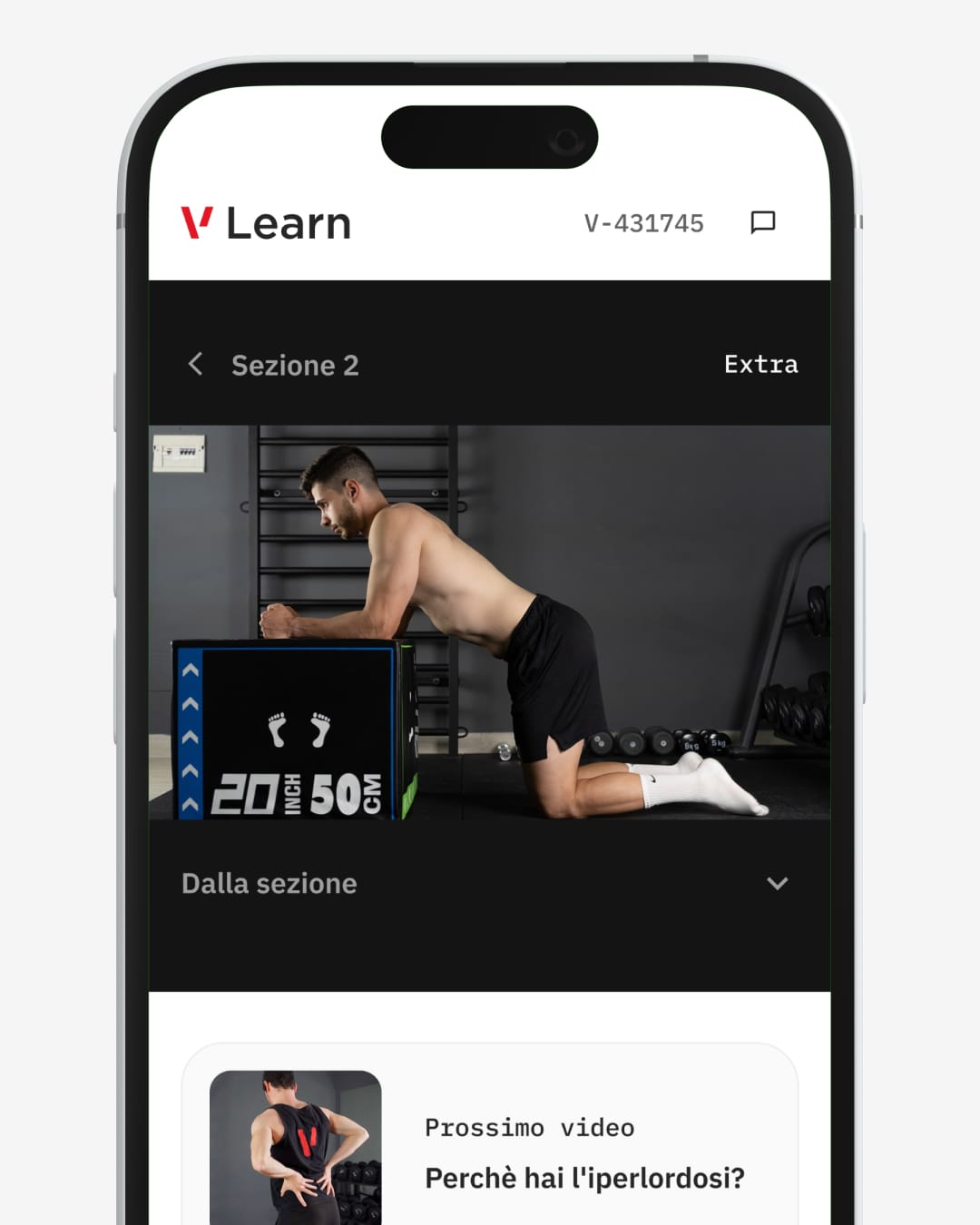 iperlordosi pagine 5