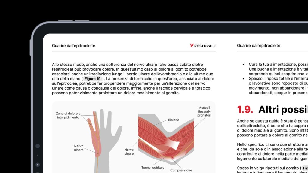 epitrocleite programma ebook