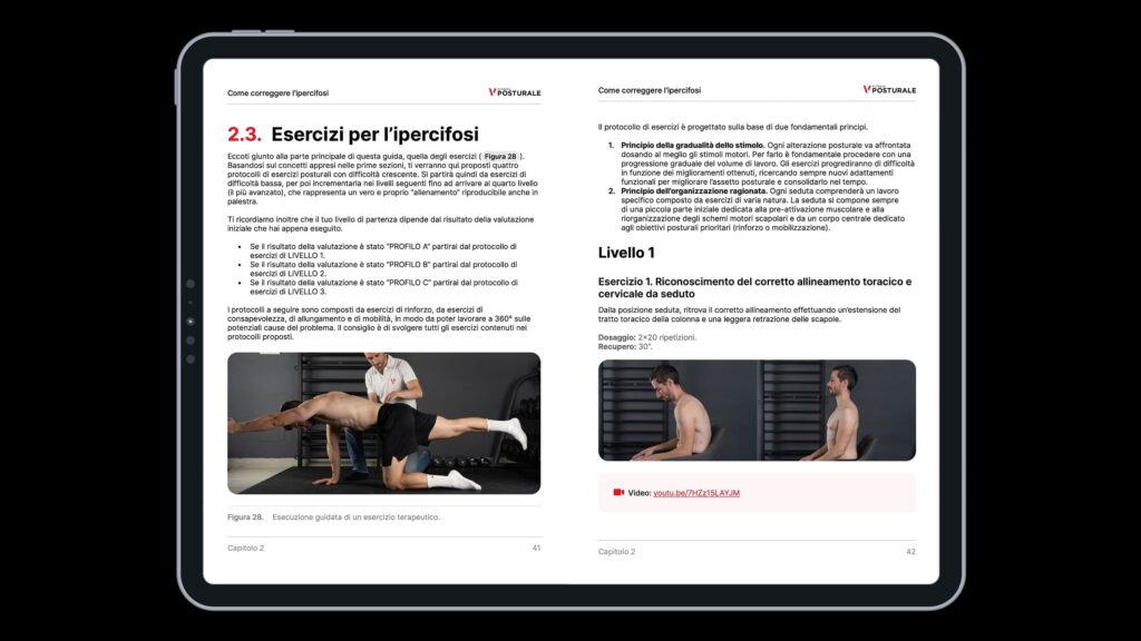 ipercifosi percorso ebook 1