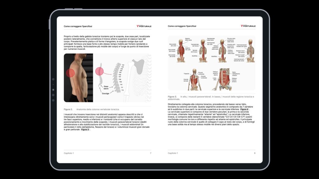 ipercifosi programma ebook 1