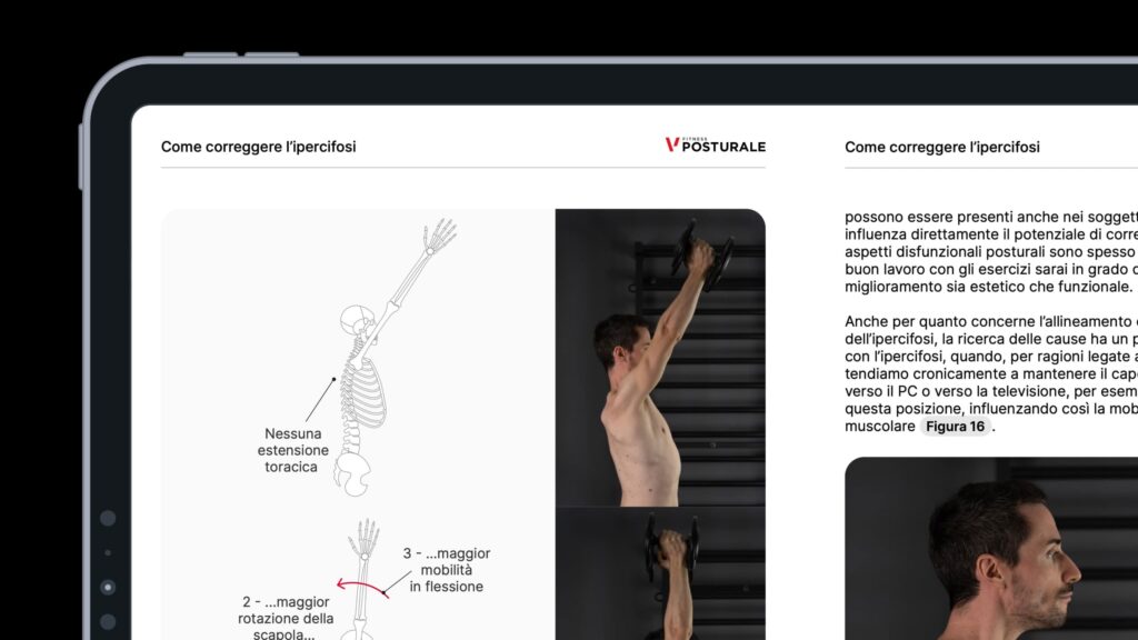 ipercifosi programma ebook 3