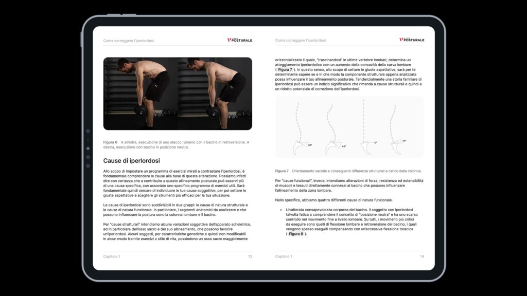 iperlordosi programma ebook 1